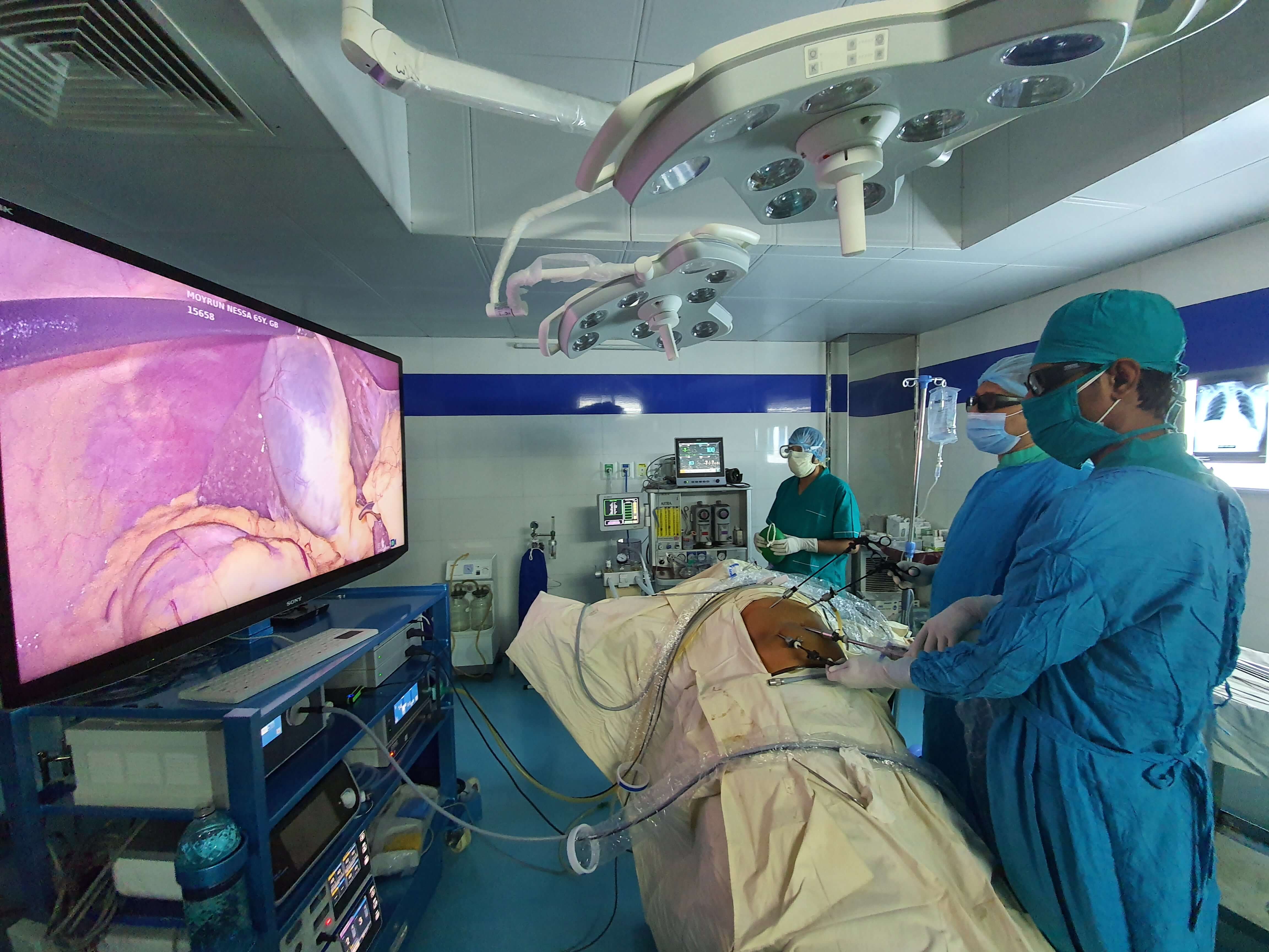 3d-laparoscopy